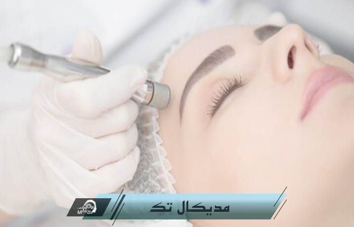 عکس تعمیرات تخصصی پاکسازی سوپر فیشیال تعمیرات تخصصی دستگاه سوپر فیشیال