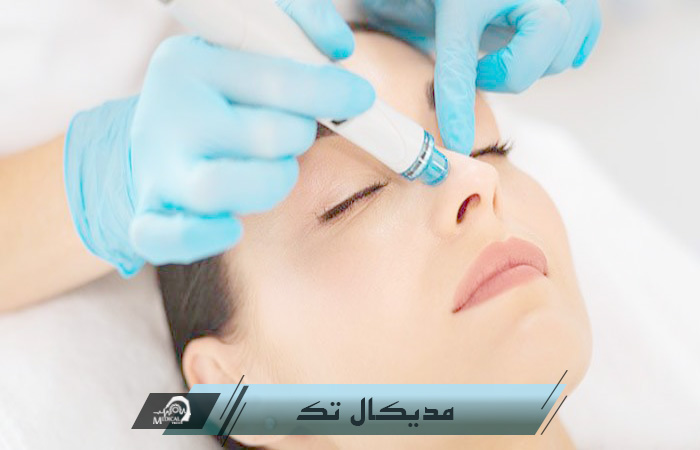 عکس تعمیرات تخصصی پاکسازی سوپر فیشیال تعمیرات تجهیزات دستگاه سوپر فیشیال