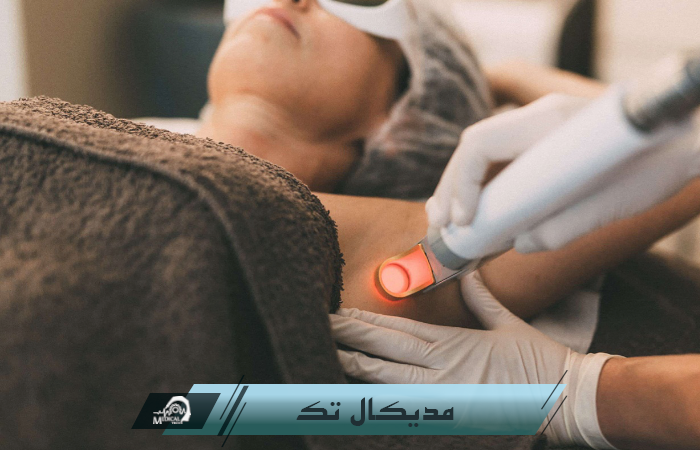 تعمیر دستگاه ناپلکس