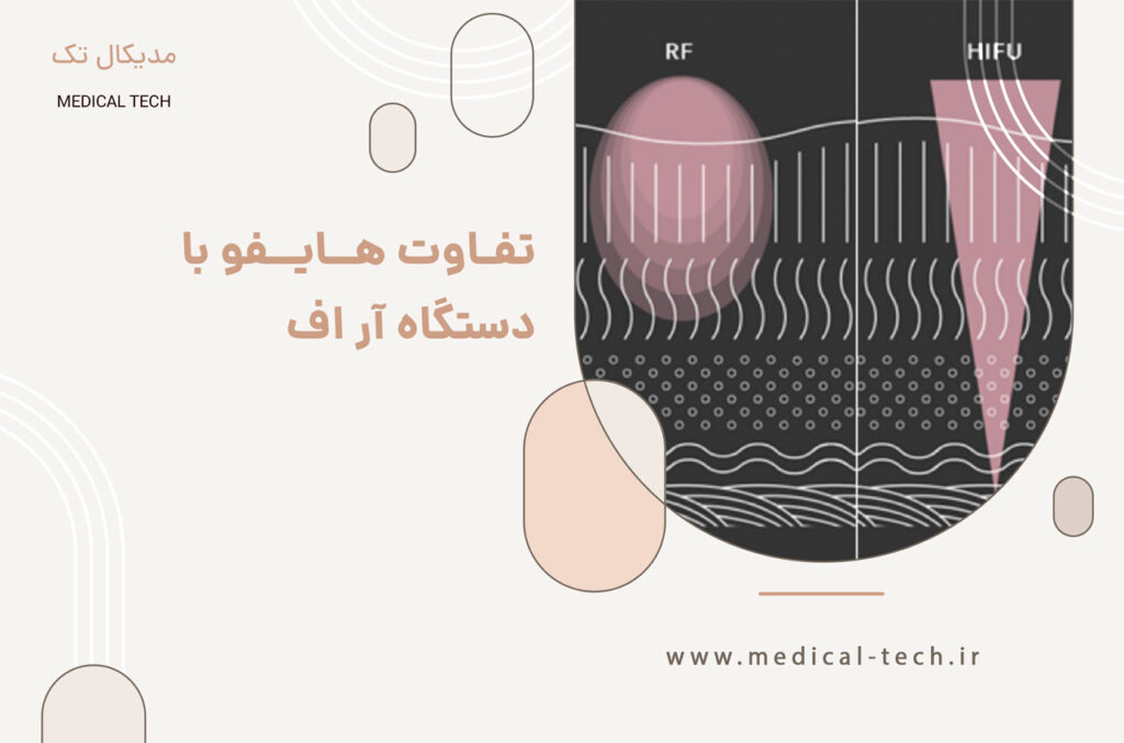 تفاوت هایفو با آر اف
